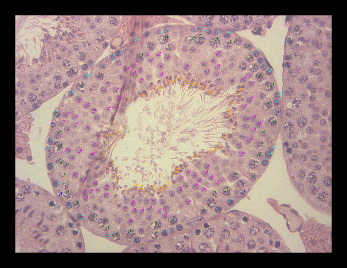 2024-12-05_405_conteo.png